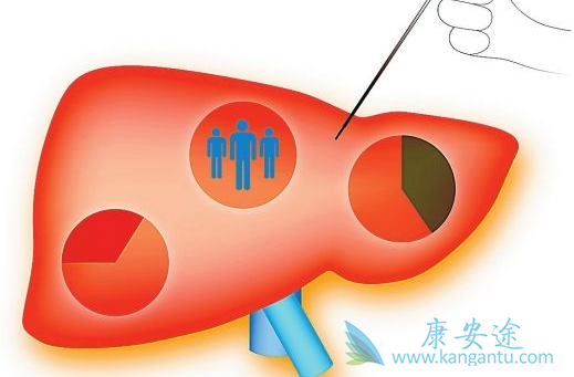 乙肝预防 乙肝预防