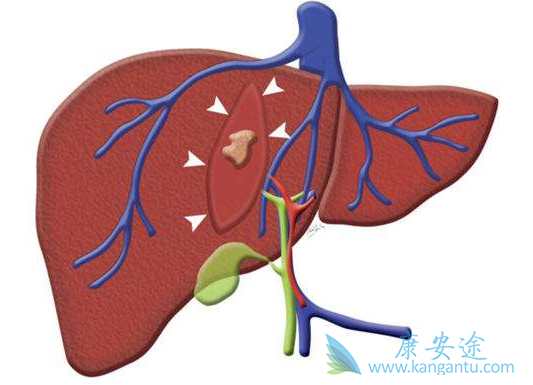 乙肝早期症状 乙肝早期症状