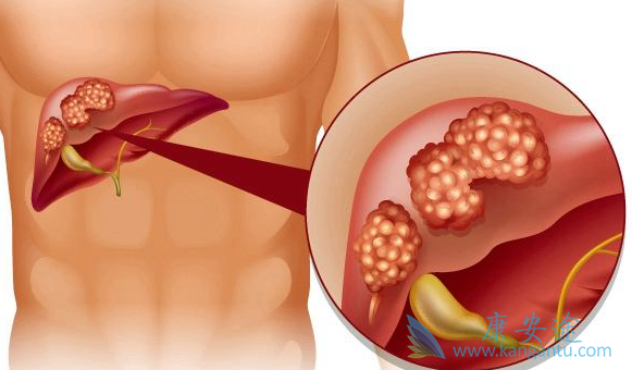 ���ε�֢״����Щ