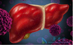 �������Ա�������������?��������Щ֢״?