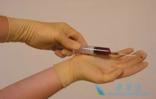 乙肝症状 乙肝症状