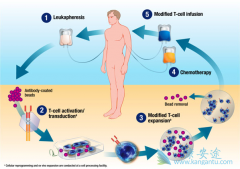 ʲô��CAR-Tϸ�����ƣ�CAR-Tϸ�����Ƶ�Ч����ô����