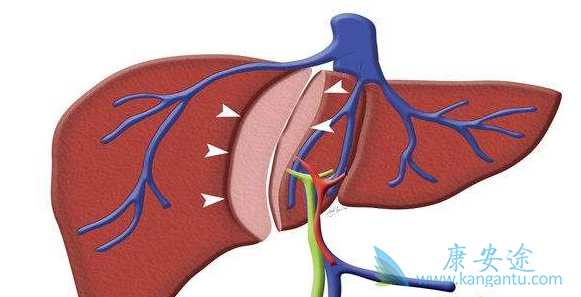 乙肝的症状 乙肝的症状