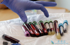 �����������Ʒ���CAR-Tʲôʱ�������У�