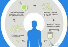 ��ô����ȥ��������CAR-Tϸ�����ƣ��й���CAR-T�Ʒ���