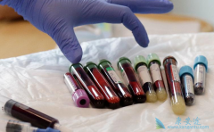 CAR-Tϸ���Ʒ���ʵ������Ч����ô����CAR-Tϸ������Ч������