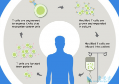 CAR-T�����Ĳ�����Ӧ����Щ��������