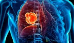 �����ʺ������ʶ��ܸߵķΰ��ᴫȾ��