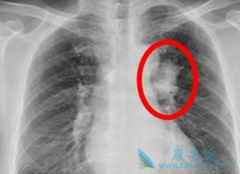 �ΰ������ڼ��ʲô�����ڻ��⻼�ߵĲ�����Ӧ