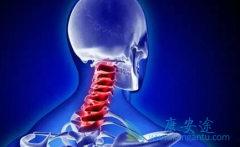 �ΰ���ת�Ƶ����Ʒ�������Ӧ֢����Щ��