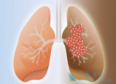 �ΰ�������֢״����Щ���ΰ����ڻ��ܻ��ã�