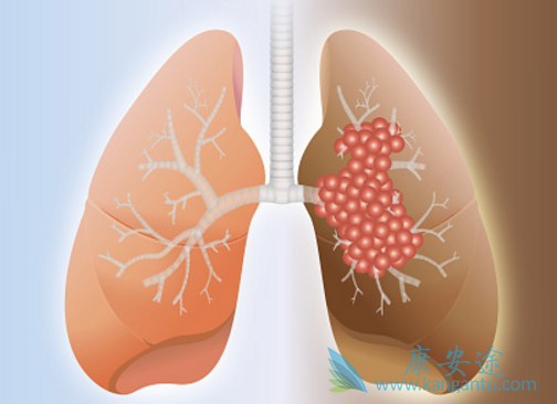 �ΰ�����