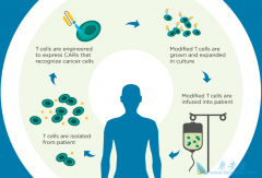 CAR-Tϸ�����Ʊ���Ϊ�����Ǳ���İ�֢���Ʒ���