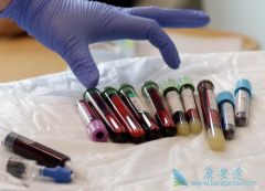 CAR-Tϸ������Ŀǰ��δ��ΪѪҺ�������Ƶ���ѡ�Ʒ�