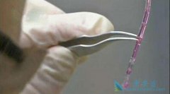 ����ҽ����3D��ӡʵ��Ѫ������