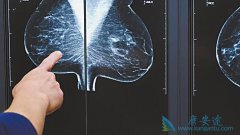 ����ҽ���������������ٰ���֢״����Щ