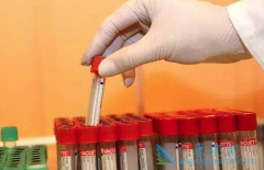 ����ŵ��ʹ���ߵ�HIV�������������