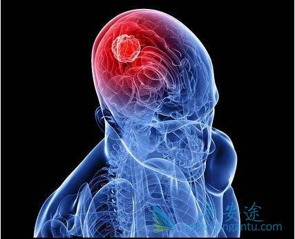 海外医疗 海外医疗