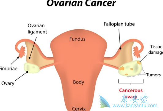 奥拉帕尼 奥拉帕尼