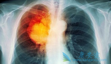 奥希替尼 奥希替尼