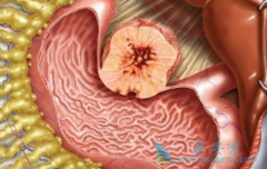 ��Щθ��������������������Ҫ������/�������Ḩ������