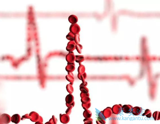 多发性骨髓瘤的症状 多发性骨髓瘤的症状