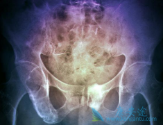 ʲô�Ƕ෢����������ο��෢�����������س̶�