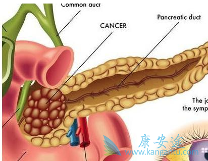 ���ٰ�������