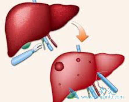 ���δ�Ⱦ��