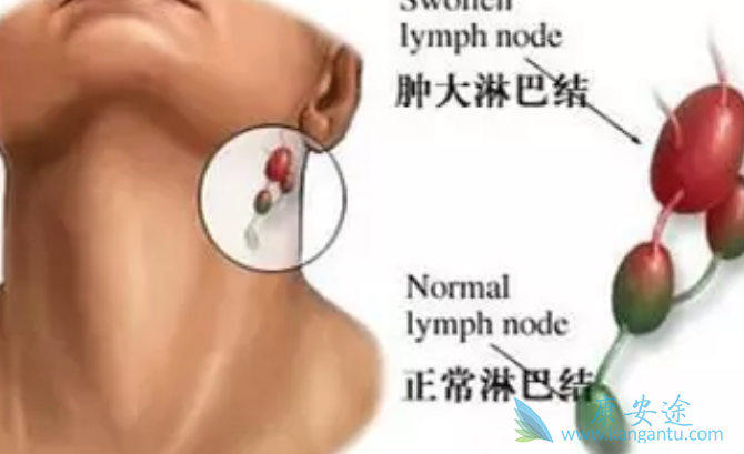 �ܰͰ���֢״