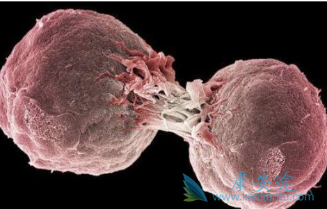 淋巴癌原因 淋巴癌原因