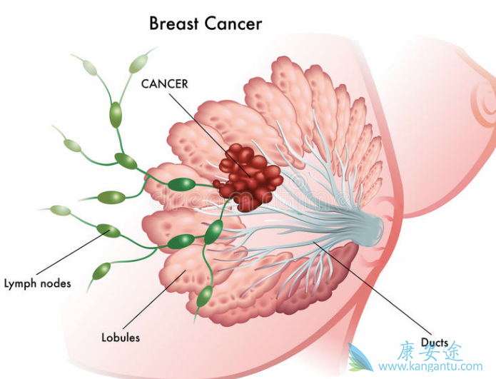乳腺癌的发病原因 乳腺癌的发病原因