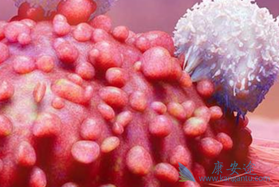 淋巴癌治疗方案 淋巴癌治疗方案