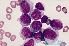 ��Щ֢״�ǰ�Ѫ��ǰ�ף���Ѫ����Σ��Ⱥ����Щ��