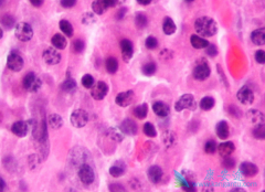 ������֢״����Щ�������ƵĻ��������ܻ��ã�