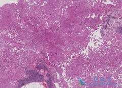 ʲô�Ƕ��Լ�Ƥ����Ŀǰ���ƶ��Լ�Ƥ���ķ�������Щ��