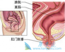 ֱ����֢״�����ڻ���ִ���Ѫ����