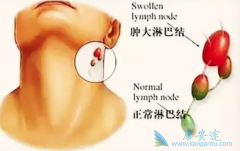 ���ڱ��ʰ�֢״�����ر����ױ����ߺ���