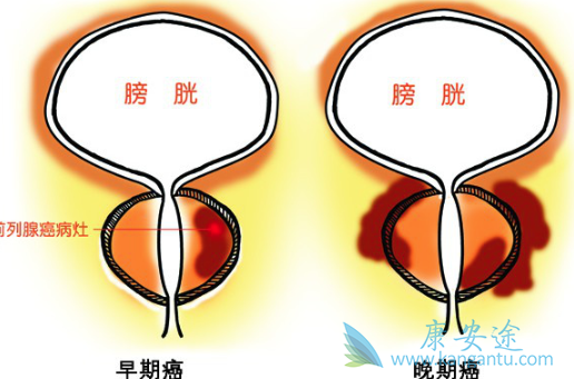 ǰ���ٰ�֢״