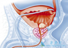 ǰ���ٰ��ܻ���ȡ�����Ƿ������Ч����