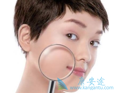 皮肤癌症状 皮肤癌症状