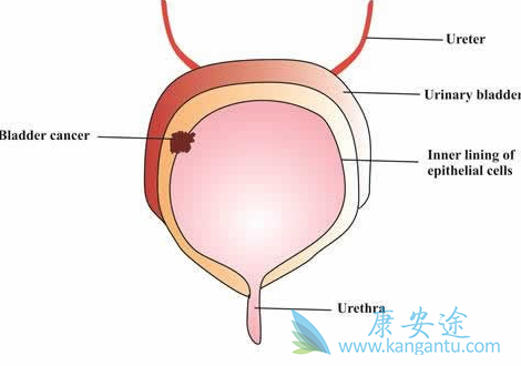 雷莫卢单抗 雷莫卢单抗