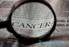 ��֢���Ʒ�������Щ�������ǰ�֢���Ʒ�����ѡ