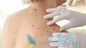 海外医疗 海外医疗