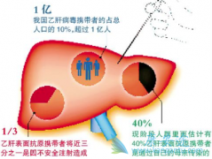 �Ҹα��濹���������費��Ҫ��������