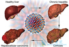 �Ҹβ���Я���ߴ�Ⱦ����ע���⼸������