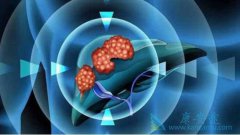 �Ҹλ�����ô�����ܼ��ٶ��濨Τ��ҩ�ԵĲ���