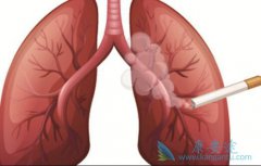 ʲô�Ƿ�Сϸ���ΰ������Сϸ���ΰ���������ص���������Щ��