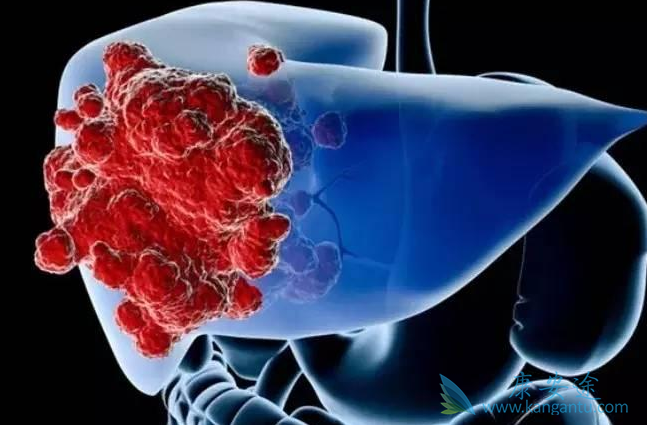 瑞格菲尼 瑞格菲尼