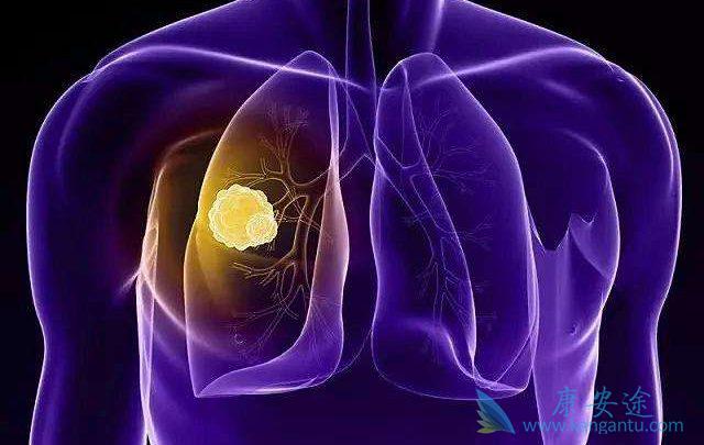 海外医疗 海外医疗